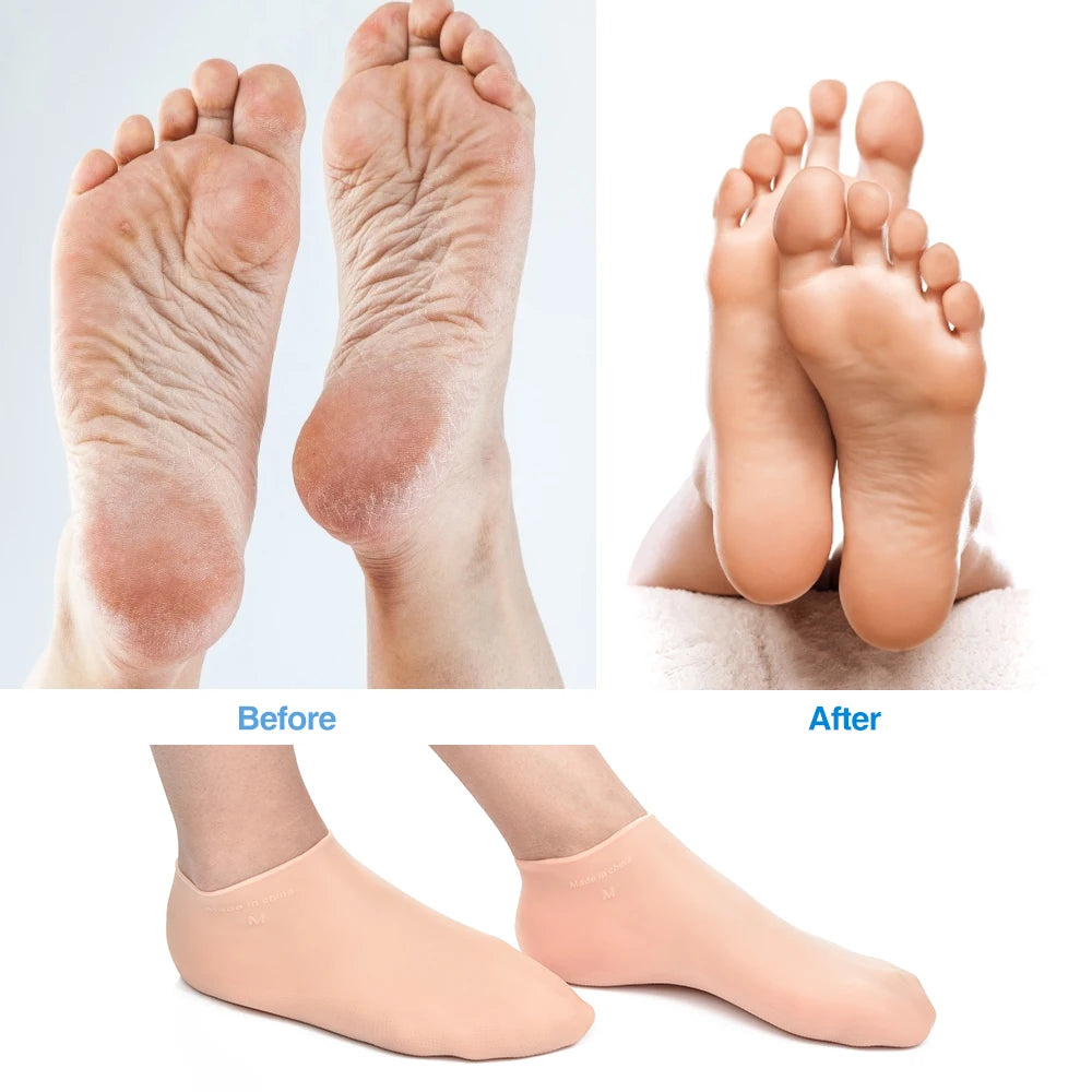 Experience the ultimate foot and hand care with our Moisturizing Silicone Gel Socks & Gloves! Designed to hydrate and repair cracked skin, these soft, elastic, anti-skid accessories are perfect for winter care. Restore smooth, healthy skin and relieve dryness for feet and hands. Available in multiple sizes for men, women, and kids. Ideal for home spa treatments.